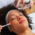 Types of Chemical Peels: A Comprehensive Guide to Skin Rejuvenation Treatments