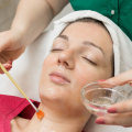 The Amazing Benefits of Chemical Peels for Skin Rejuvenation