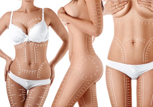 All You Need to Know About Liposuction