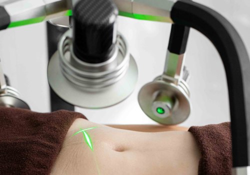 Understanding Cryolipolysis: A Non-Surgical Body Contouring Technique